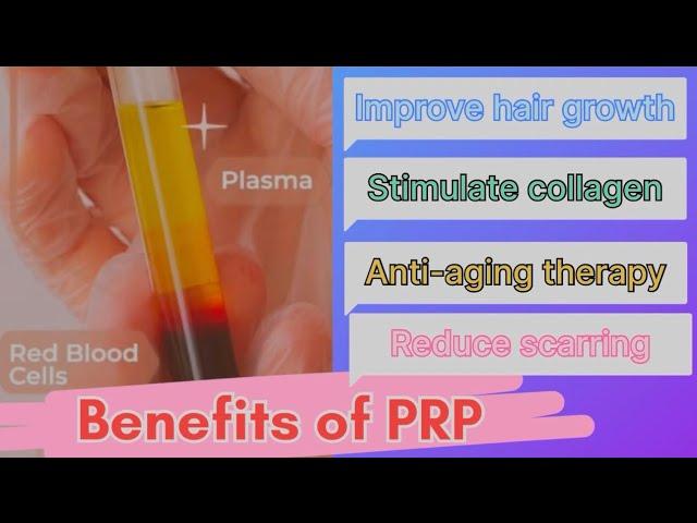 Treatment for hair loss #prp for hair