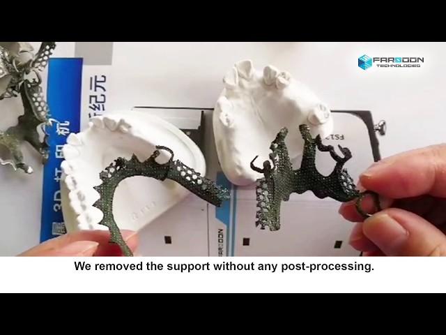 3D Printed Removable Partial Denture (RPD) by Farsoon FS121M Machine