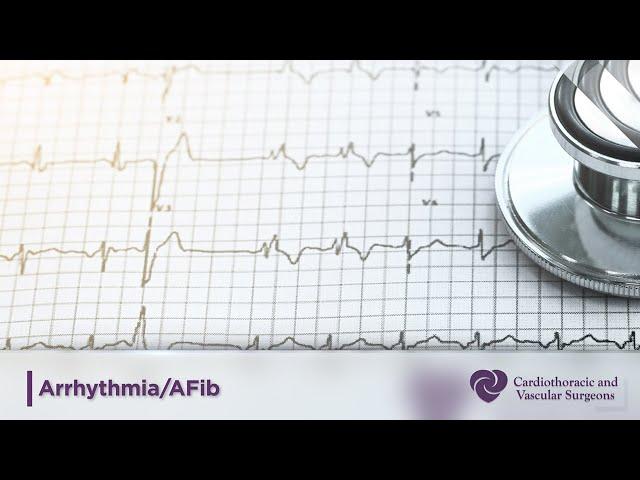 Arrhythmia | Atrial Fibrillation | Afib | Cardiothoracic Surgery | CTVS Texas