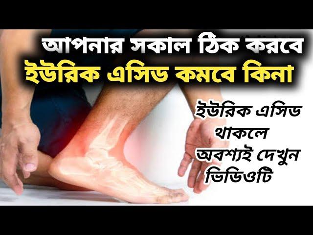 সকালের ৫ টি পানীয় যা ইউরিক এসিডের যম।Best 5 morning drinks to reduce uric acid fast ।