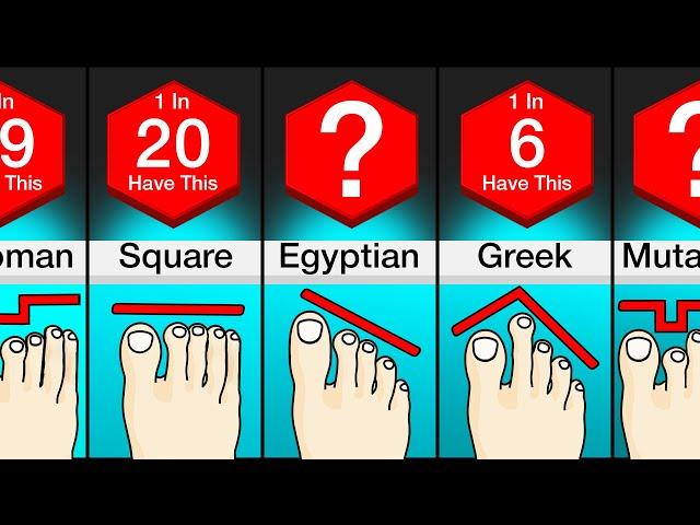 Comparison: Different Types Of Feet