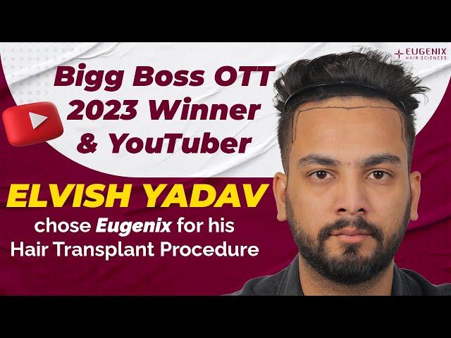 Celebrity Hair Transplant: Elvish Yadav trusts Eugenix for his hair transplant journey