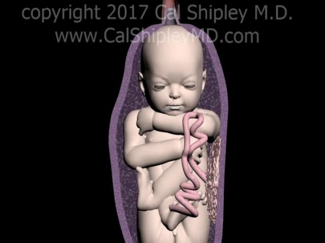 The Nonstress Test - Animation and Narration by Dr. Cal Shipley, M.D.
