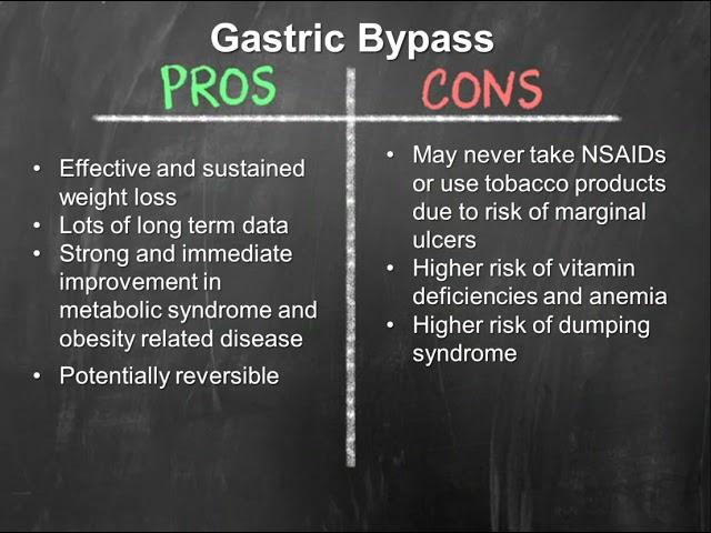 Types of Weight Loss Surgery | OSF Saint Francis Medical Center