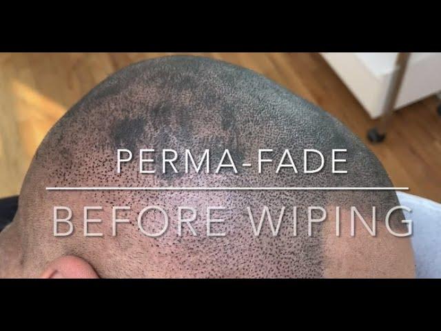 Hair Tattoo - Permanent Fade - Scalp Micropigmentation