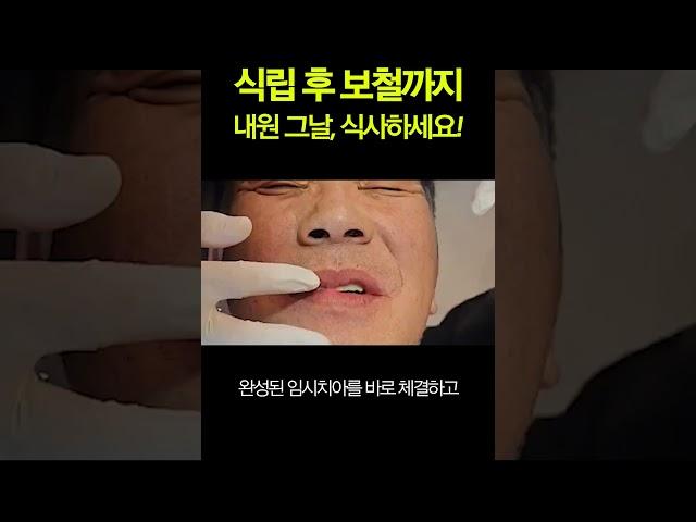 풀아치 임플란트 식립 후 바로 보철까지 바로 식사하세요!
