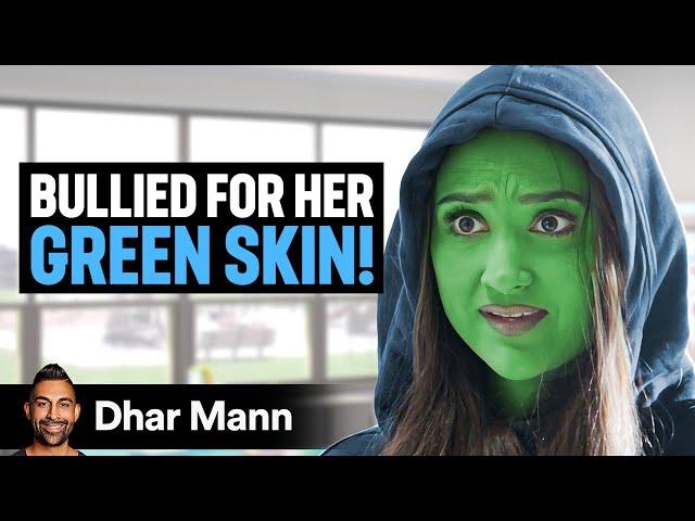 GIRL BULLIED For Her GREEN SKIN! | Dhar Mann Studios