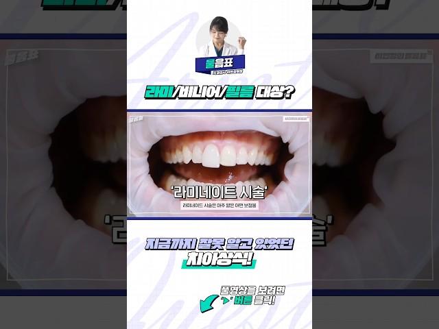 #라미네이트  #비니어 #필름 시술 대상은?