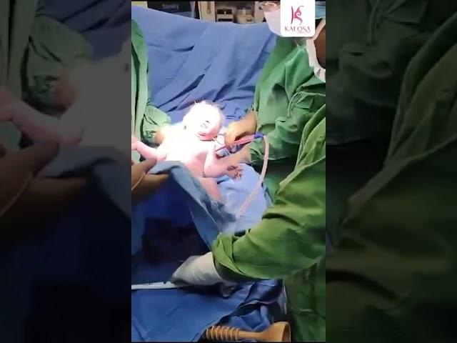 The Hidden Scenes Of Child Birth Nobody Shows You | Kalosa Gynae #shortsvideo #shortsfeed