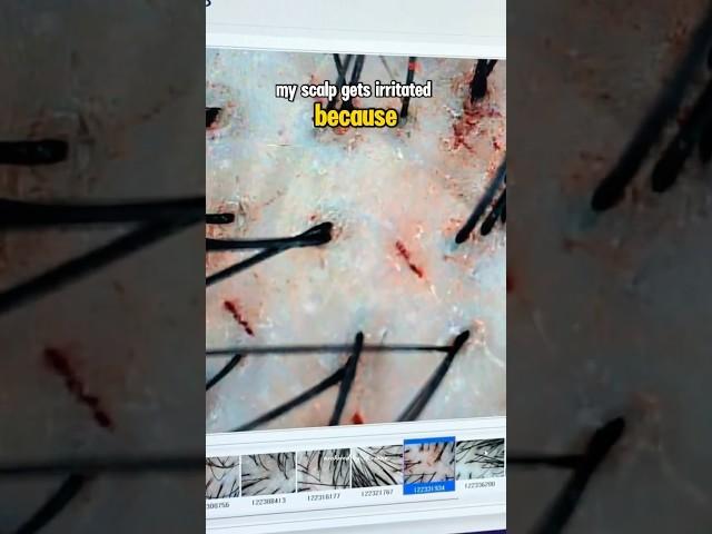 Don’t scratch your head  #haircare #scalpcare #skincaring #kbeauty #k뷰티 #creator #influencer #fyp