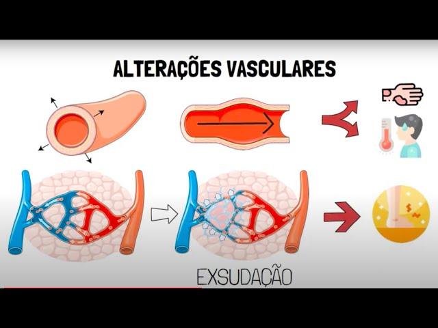 Inflamação Aguda