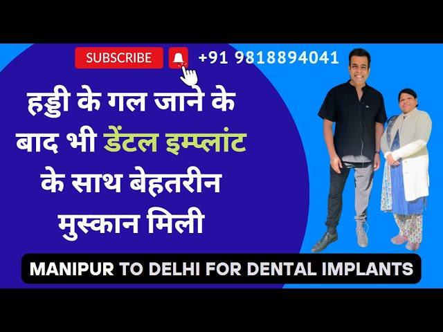 Best Dental Hospital in India | best implant dentist in India | full mouth dental implants India