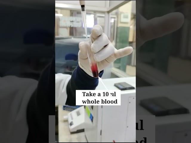 cyanmethemoglobin method  #shorts #youtubeshorts #test #bloodtest #lab