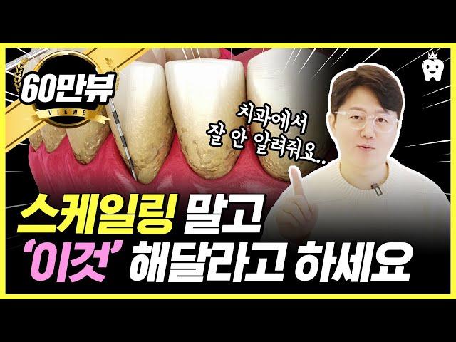 치과에서 잘 안해주는 가성비 100배 시술, 스케일링보다 좋습니다!!