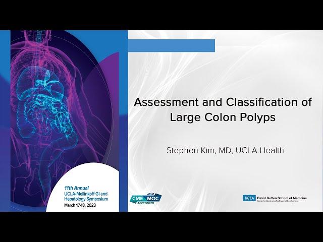 Assessment and Classification of Large Colon Polyps | UCLA Digestive Diseases