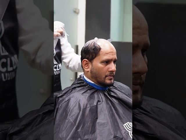 Hair Club Non Surgical