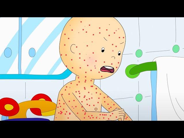 Chicken Pox | Caillou Cartoon