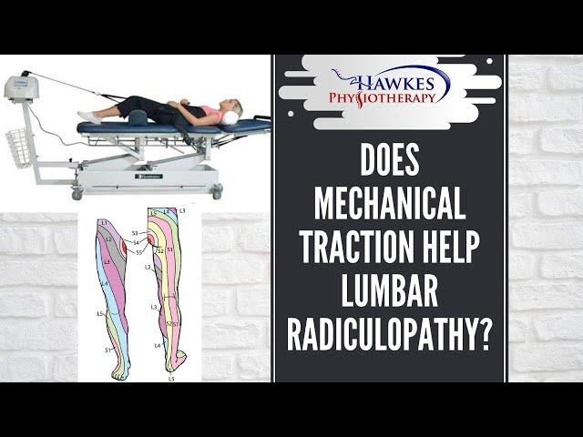 Does mechanical Traction help Lumbar Radiculopathy?