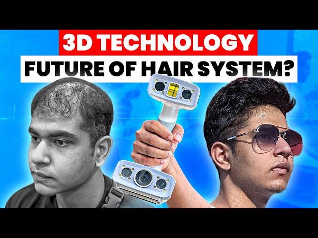 3D Technology for Hair Replacement Systems: The Game Changer!