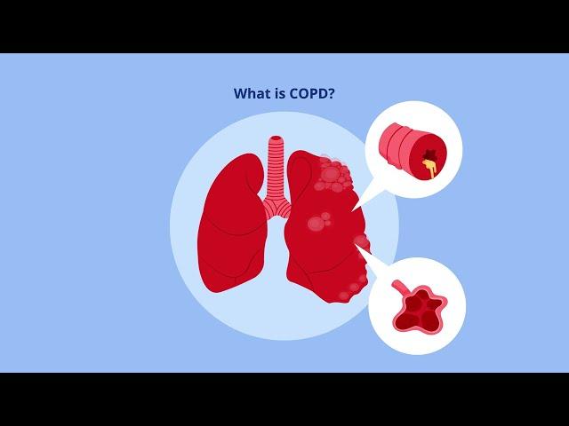 What is COPD?