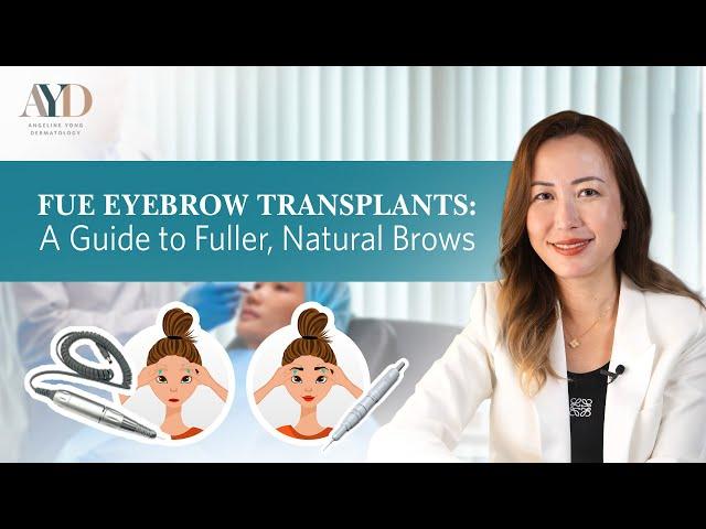 FUE Eyebrow Transplants: A Guide to Fuller, Natural Brows