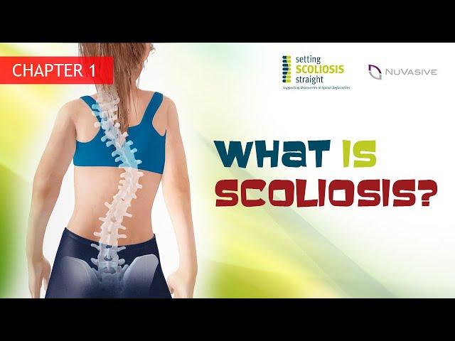 Ch.1 - What is Scoliosis?