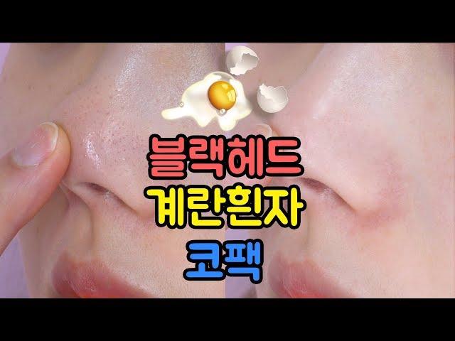 돈안들이고 계란 흰자로 집에서 코팩 만들기 !! 블랙헤드 /피지 제거하는 방법/ 코 모공 줄이는법 Black head remover┃소정 Sojeong