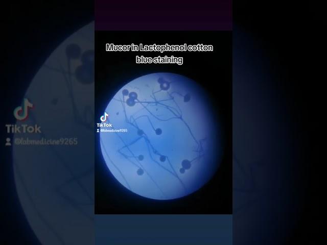Mucor in LPCB stain || Mycology