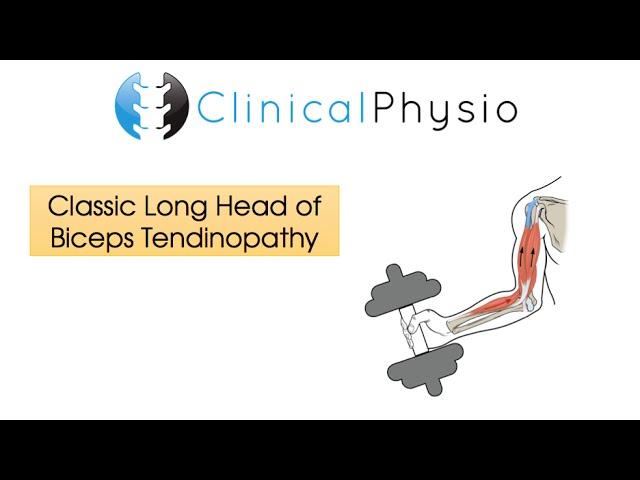 Classic Long Head of Biceps Tendinopathy | Clinical Physio