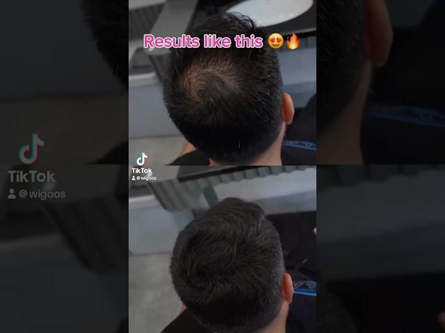 Amazing results using Batci hair concealer #wigoos #batci #batciuk #fyp #thinhairsolutions #fy