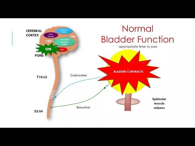 Evaluating & Treating Urinary Issues in PD, MSA, PSP, CBD, and LBD | 8-23-19 Webinar