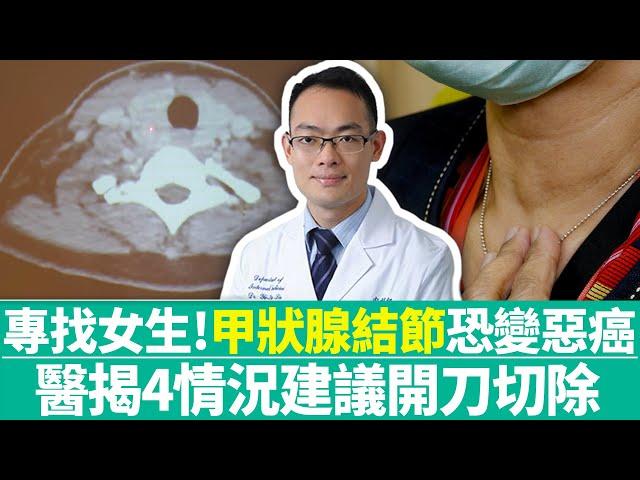 【健康療天室】專找女生！「甲狀腺結節」恐變惡癌　醫揭4情況建議開刀切除｜中時新聞網