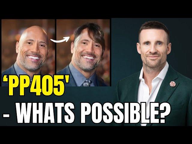 Hair Loss Doctor Breaks Down PP405: Genuine Breakthrough or Overhyped?