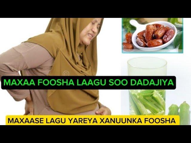 MAXAA FOOSHA LAAGU SOO DADAAJIYA MAXA NAA LAAGU YAREEYA XANUUNKA FOOSHA........