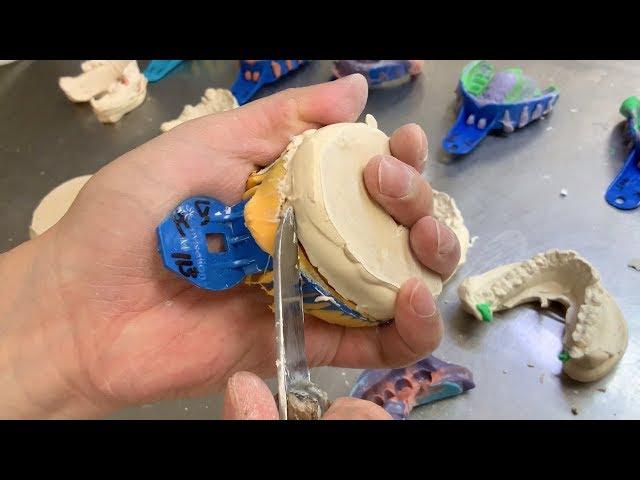 The Many Types of Model Making at a Dental Lab