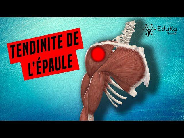 COMPRENDRE LA TENDINITE DE L'ÉPAULE [Explications professionelles]