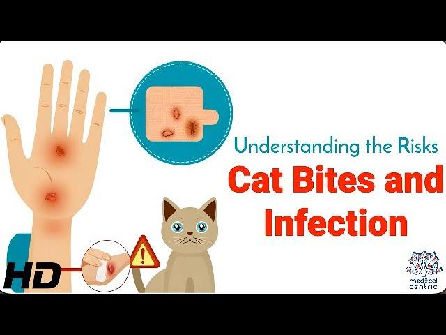 Risks Cat Bites and Infection: What Happens If You're Bitten?