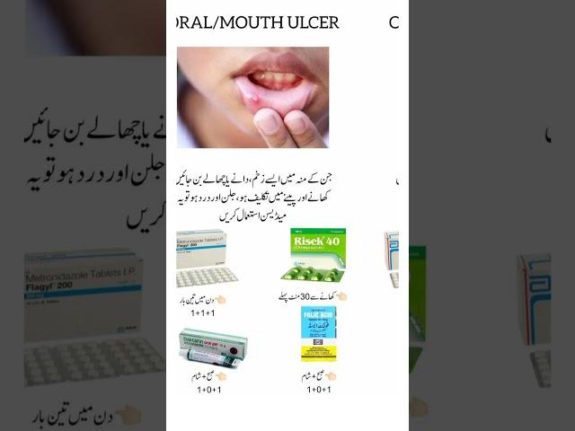 Mouth/Oral ulcer treatment #viralvideo #trending #trendingvideo #pharmacist #medicine #pharmacy