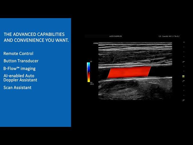 New LOGIQ P Series Ultrasound: Making Vascular Studies Efficient