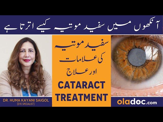 Cataract Kya Hai In Urdu/Hindi - Safed Motia Ka Ilaj - Cataract Treatment - Safed Motia Kya Hota Hai