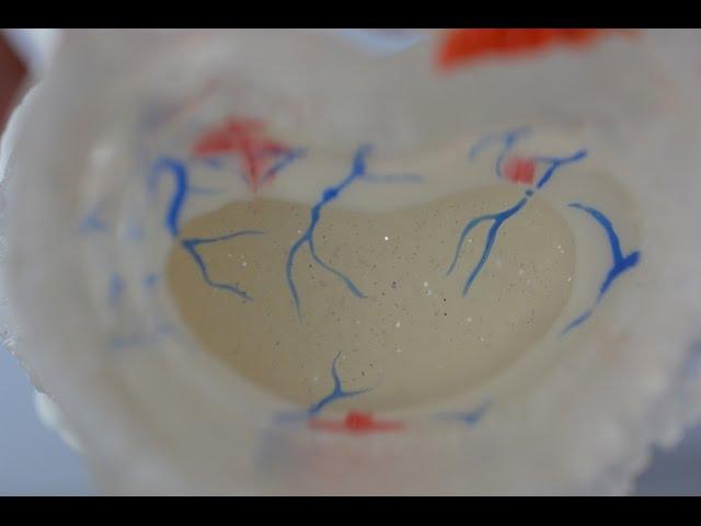 Degenerated Centralizer Lumbar Model - Dynamic Disc Designs Corp.