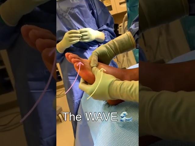 Swelling is the Enemy! #surgery #ankle #edema #postoprecovery #postopcare