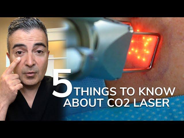 5 Things to Know About CO2 Laser Resurfacing