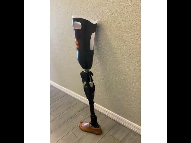 Look at this AK suction socket prosthesis with a Blatchford Linx microprocessor knee and ankle.