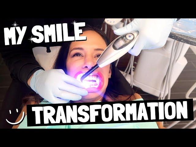 MY SMILE TRANSFORMATION!!! | JO DE LA ROSA GRAY