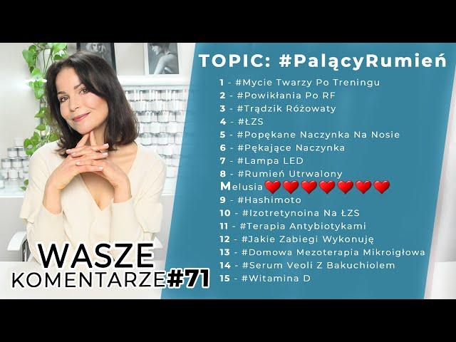 Palący Rumień | Wasze Komentarze#71