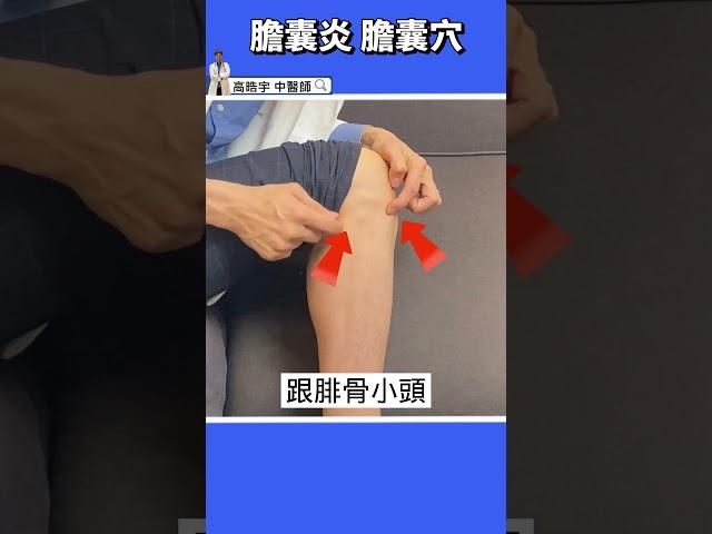 【膽囊炎、膽結石特效穴】30秒超有效解痛，膽囊發炎結石者必看！！ #shorts #高醫師說 #中醫 #高晧宇中醫師 #痠痛