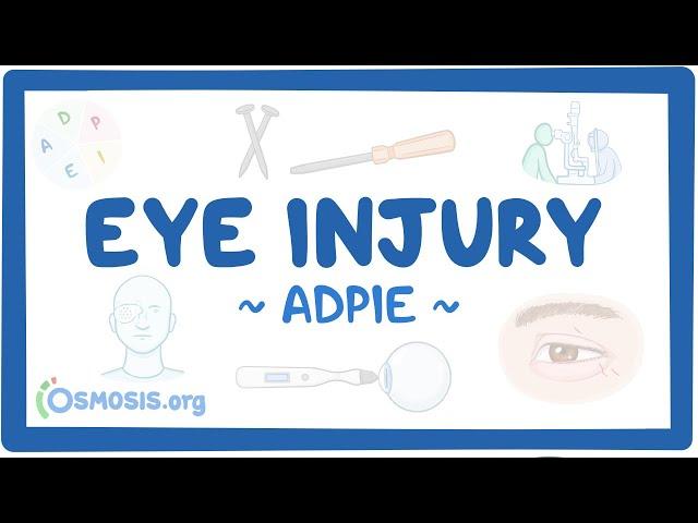 Eye injury: Nursing Process (ADPIE)