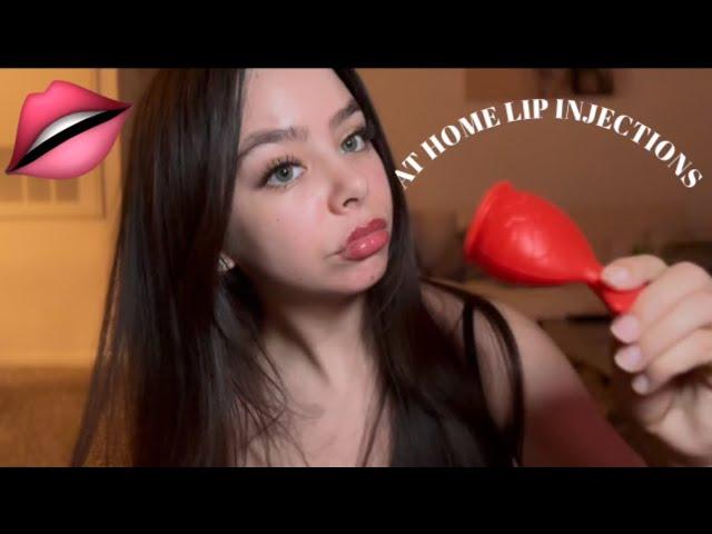 I TRIED A VIRAL LIP PLUMPER FROM AMAZON | DIY LIP INJECTIONS