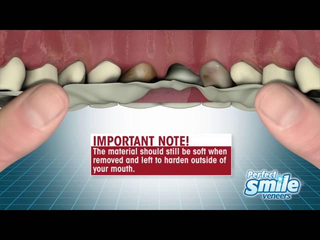 Perfect Smile Veneers Instructional - Getting Started